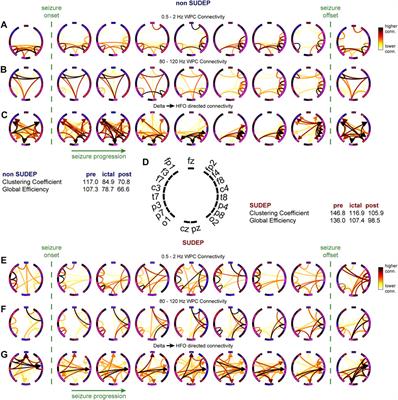 A Peri-Ictal EEG-Based Biomarker for Sudden Unexpected Death in Epilepsy (SUDEP) Derived From Brain Network Analysis